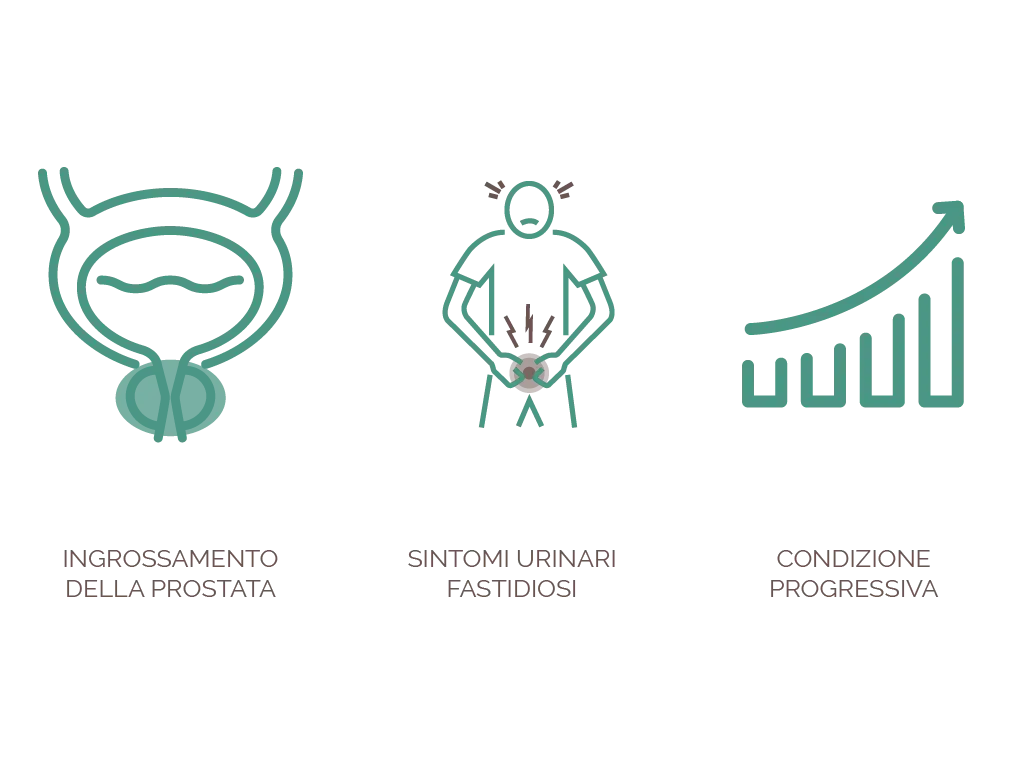 iperplasia prostatica benigna sintomi