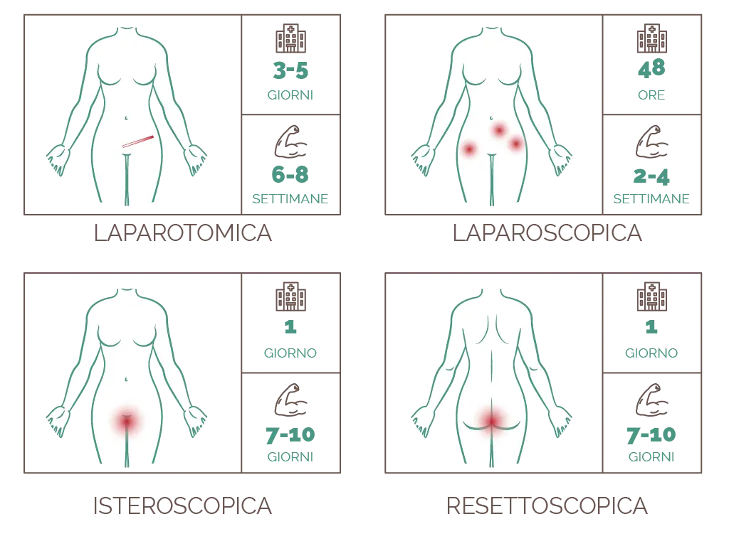 miomectomia laparotomica tempi di recupero
