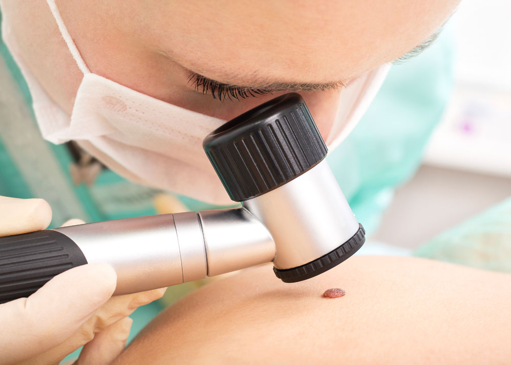 dermatoscopia digitale milano