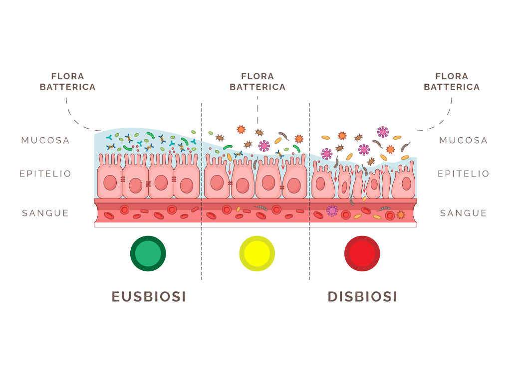 disbiosi intestinale sintomi