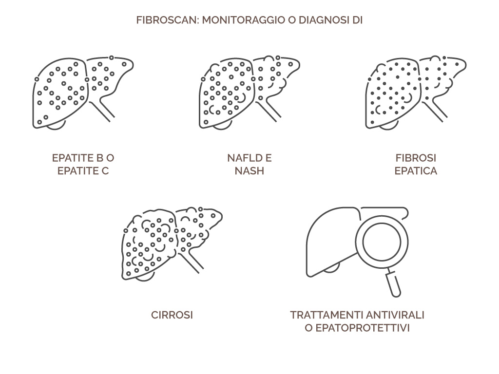 fibroscan