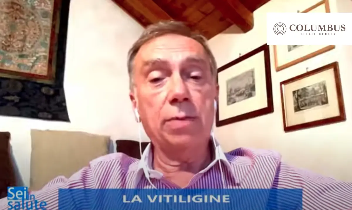 vitiligine prof leoni